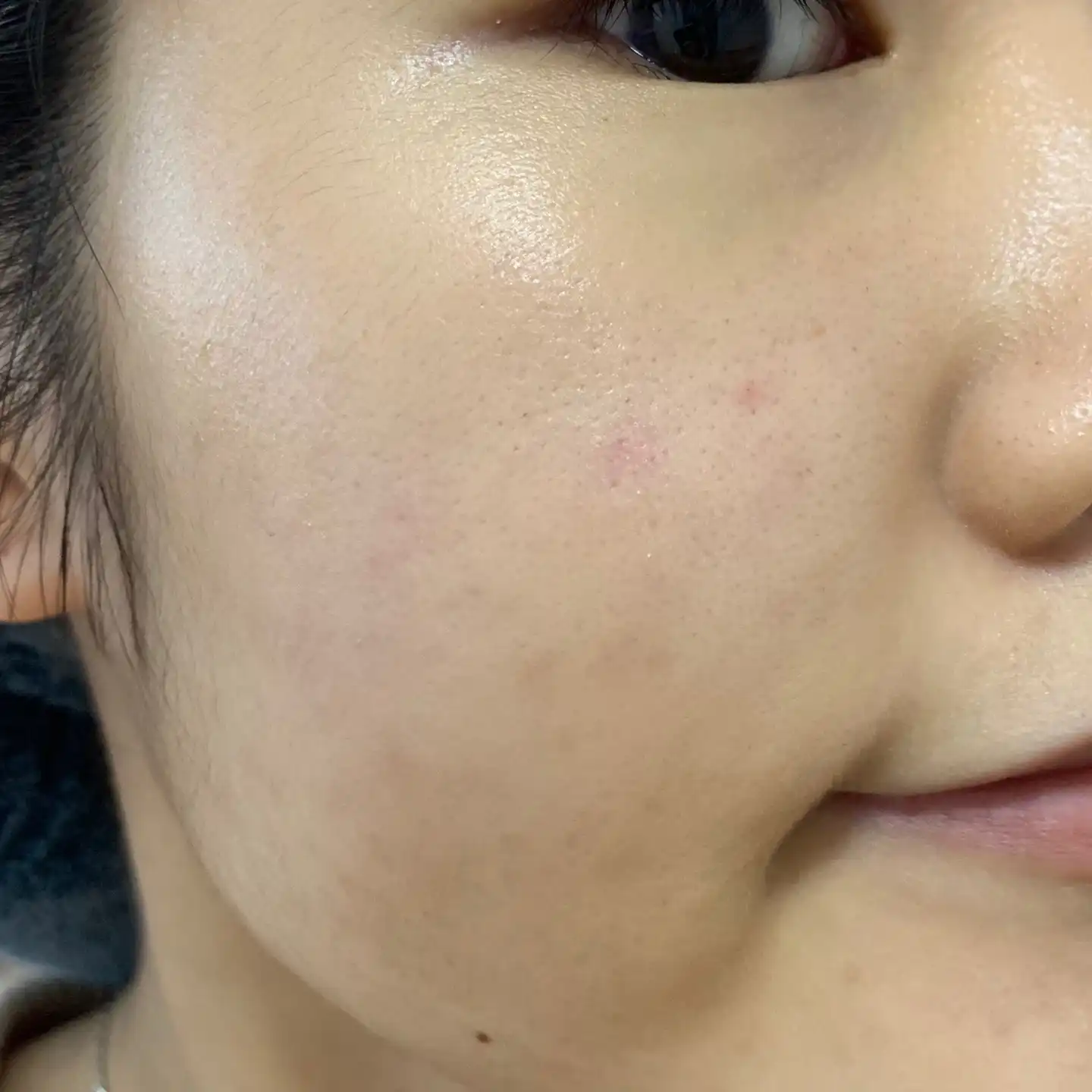 겟리프 트윈패드팩