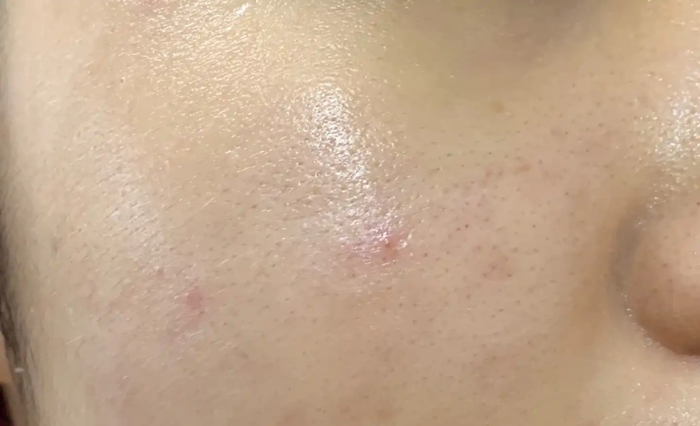 블랙티 유스 인핸싱 앰플