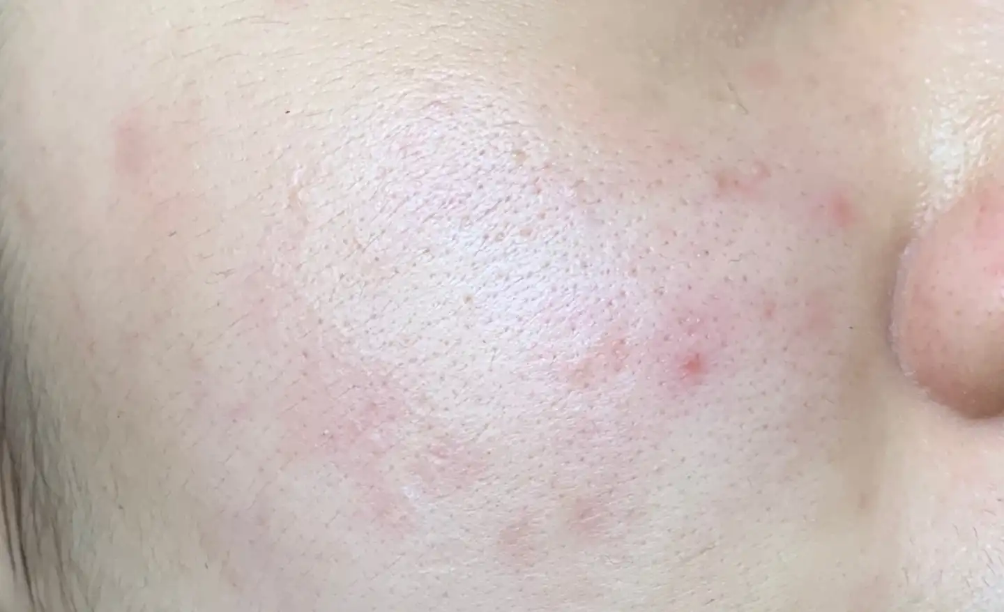 어드밴스드 나이트 리페어싱크로나이즈드 리커버리 콤플렉스 투