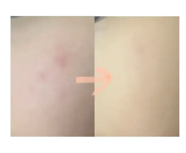 언니의파우치 리뷰 이미지 3 - [(코숏 인 서울 에디션) 킬 커버 더 뉴 파운웨어 쿠션]