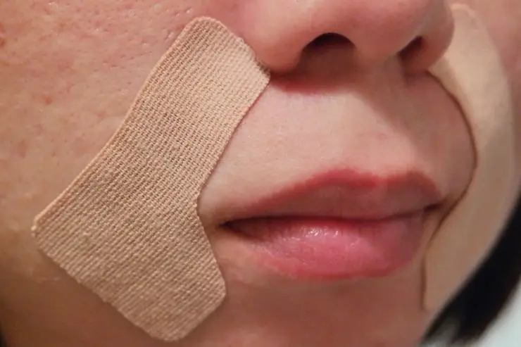 선택된 언니의파우치 리뷰 이미지 - [로로피아니 로로스키니패치_팔자주름패치]