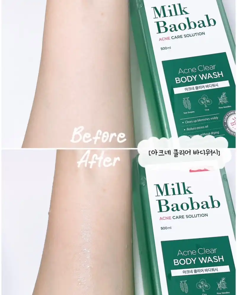 언니의파우치 리뷰 이미지 2 - [아크네 클리어 바디워시 ]
