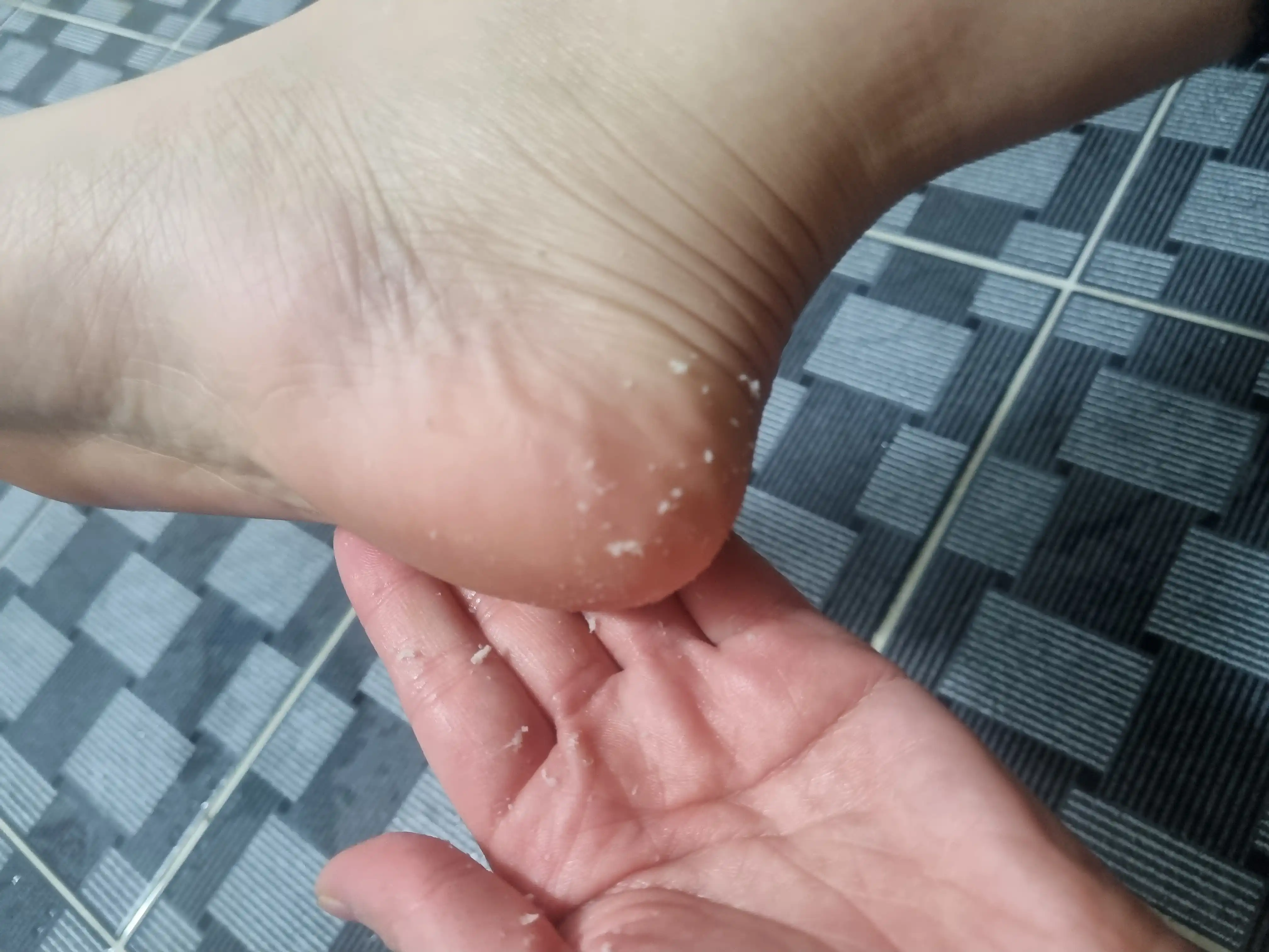 언니의파우치 리뷰 이미지 3 - [발각질벗자 풋필링 스프레이 ]