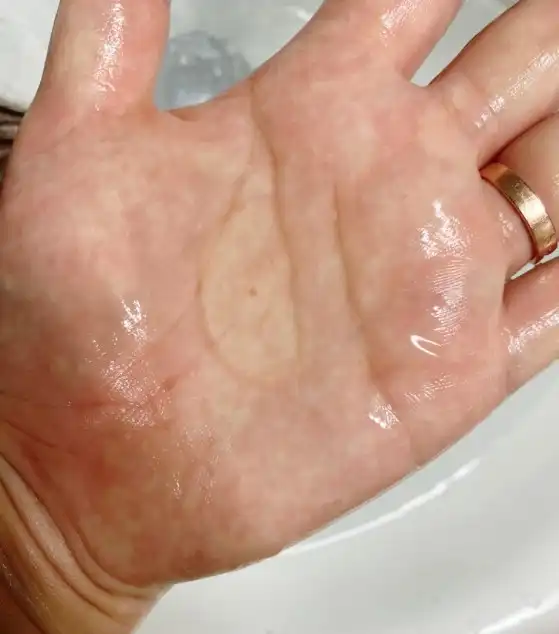 나펩 리커버리앰플