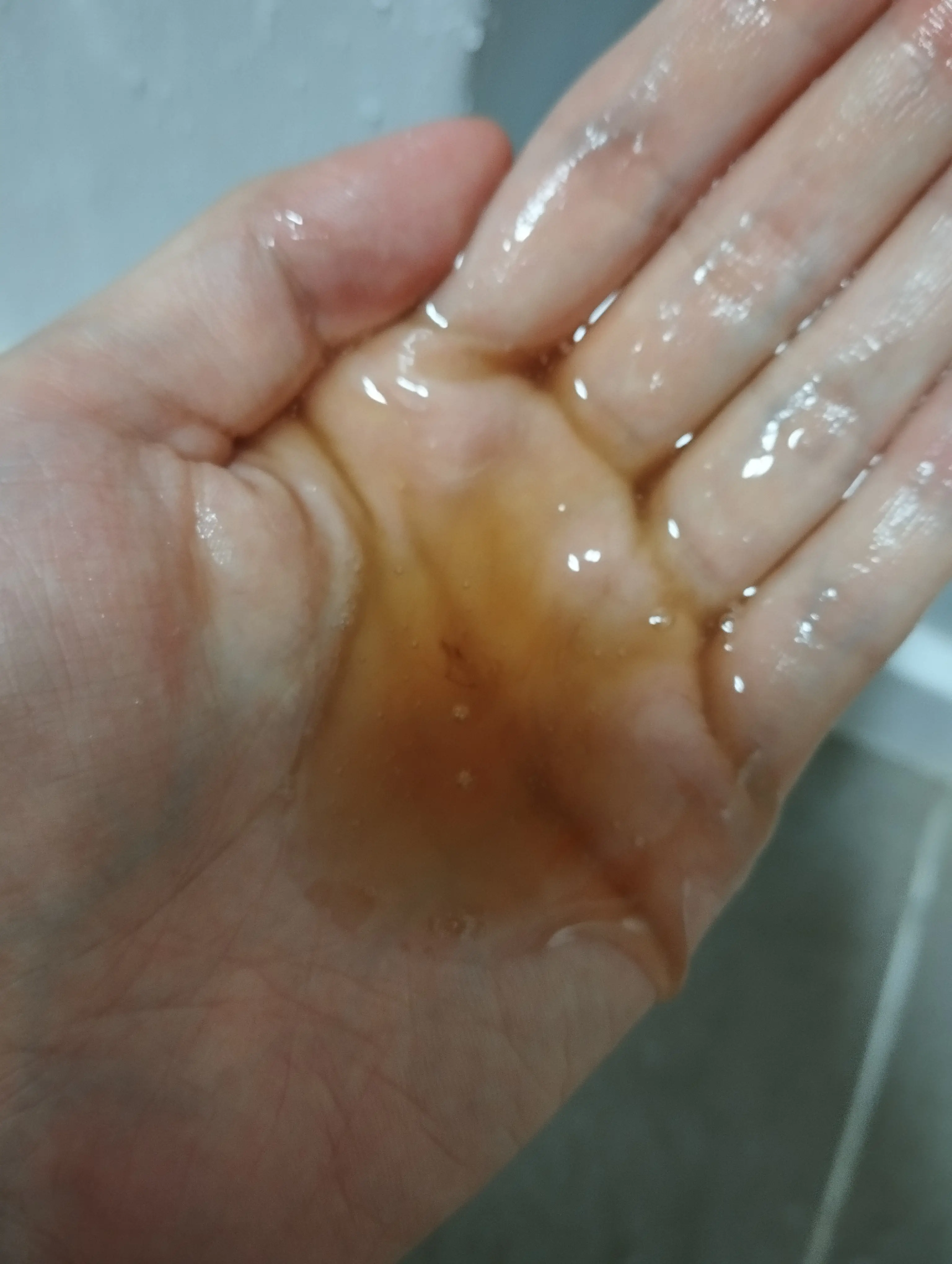 선택된 언니의파우치 리뷰 이미지 - [탈모증상완화 댄드러프클리닉]