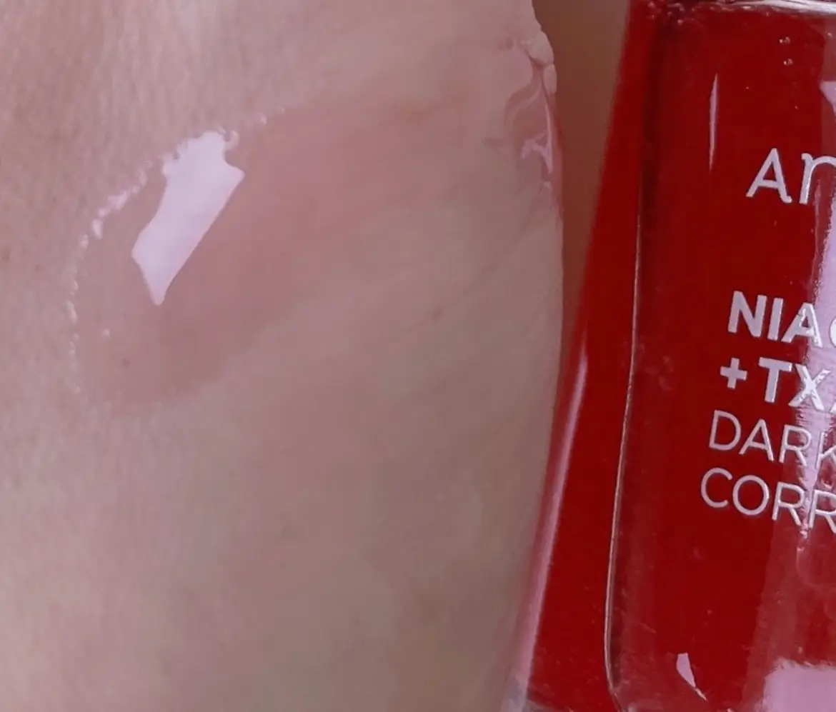 선택된 언니의파우치 리뷰 이미지 - [10 TXA 4 다크 스팟 코렉팅 세럼]