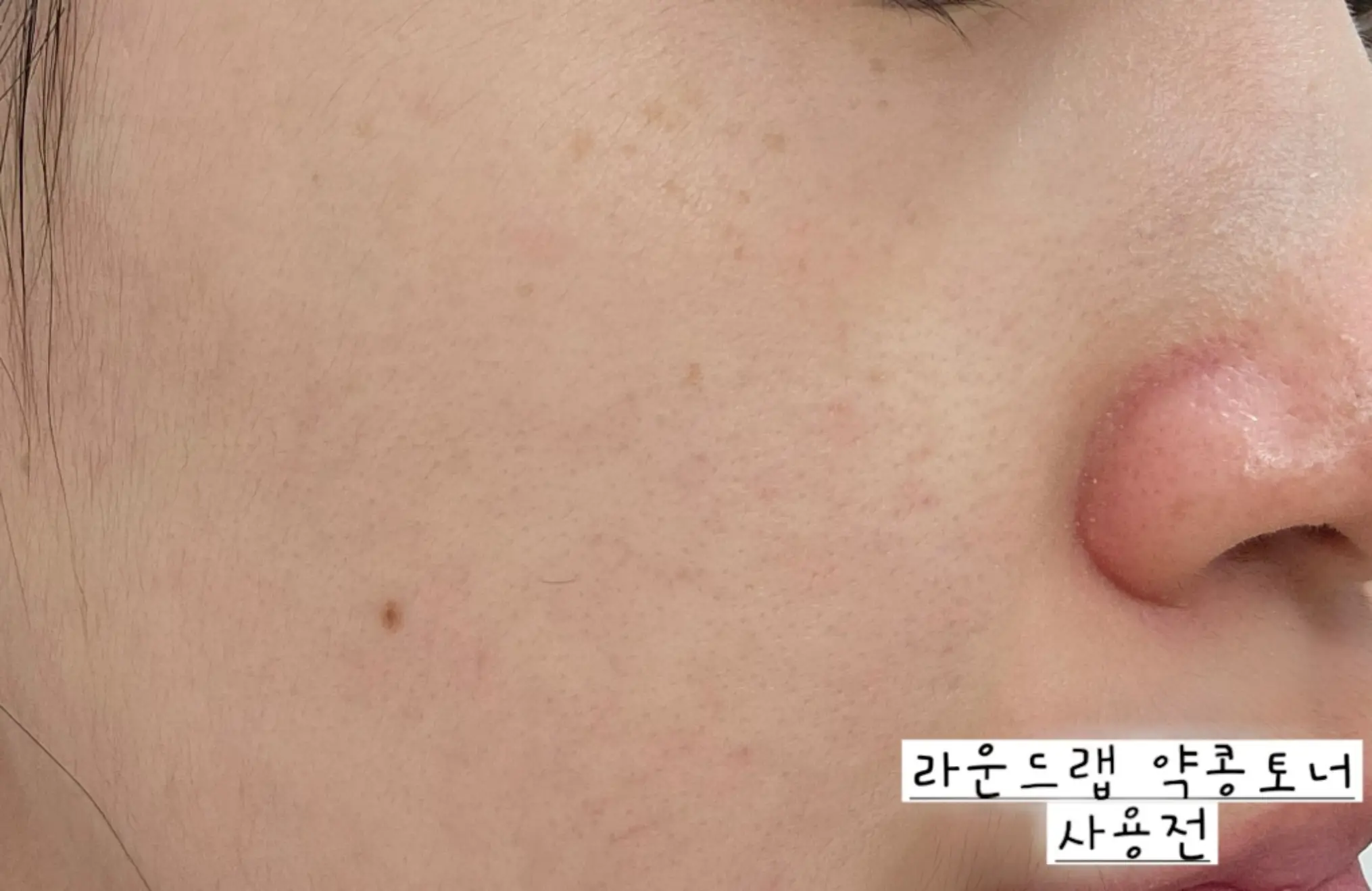 선택된 언니의파우치 리뷰 이미지 - [약콩 판테놀 토너]