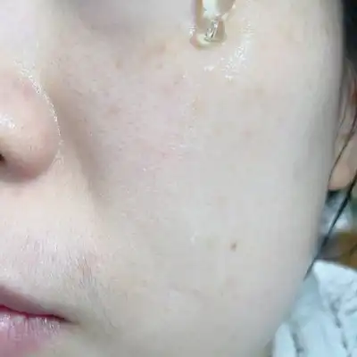 언니의파우치 리뷰 이미지 2 - [리제논 필 라하]