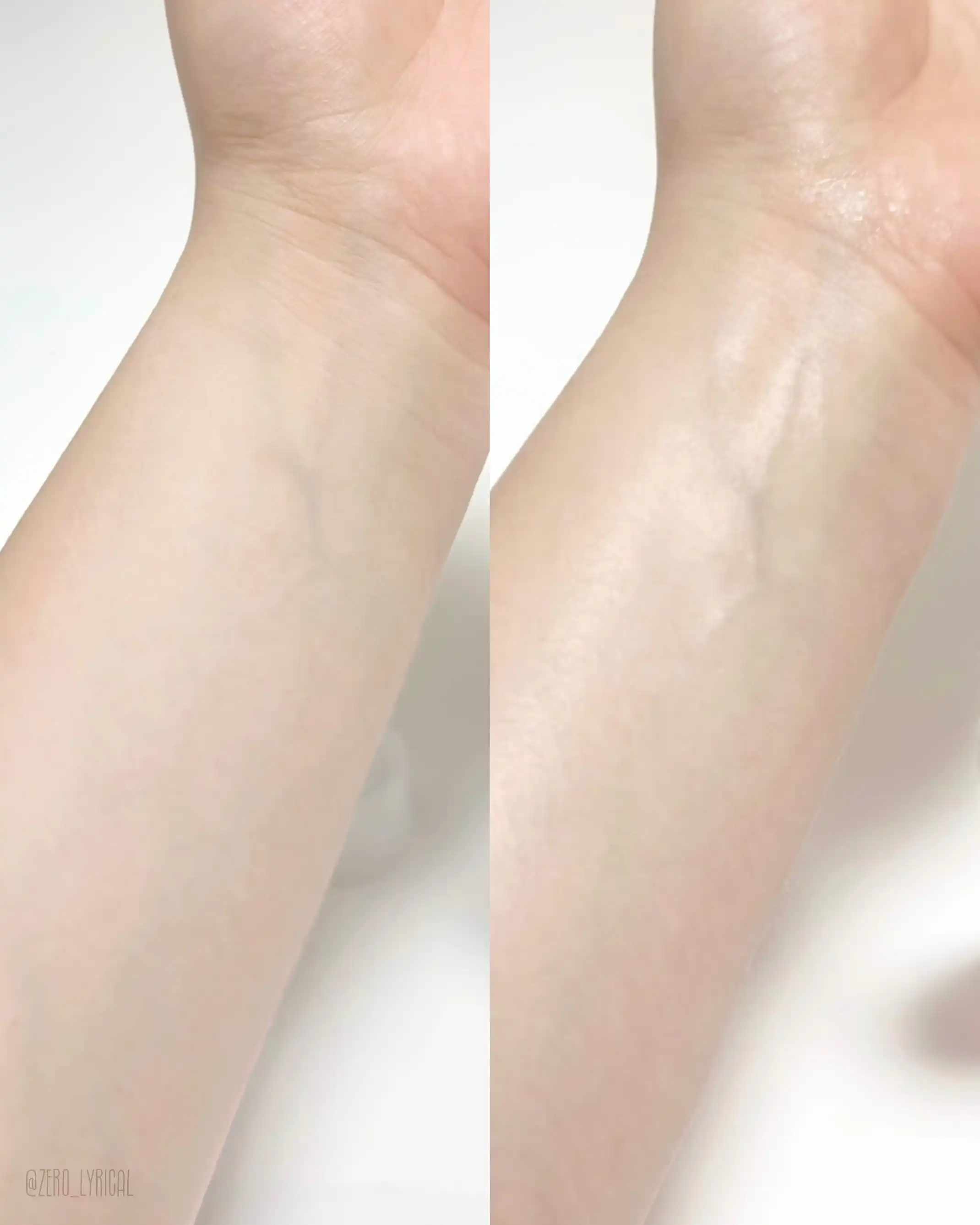 언니의파우치 리뷰 이미지 2 - [테라크네365 나이아신아마이드 5프로 흔적 바디 미스트]