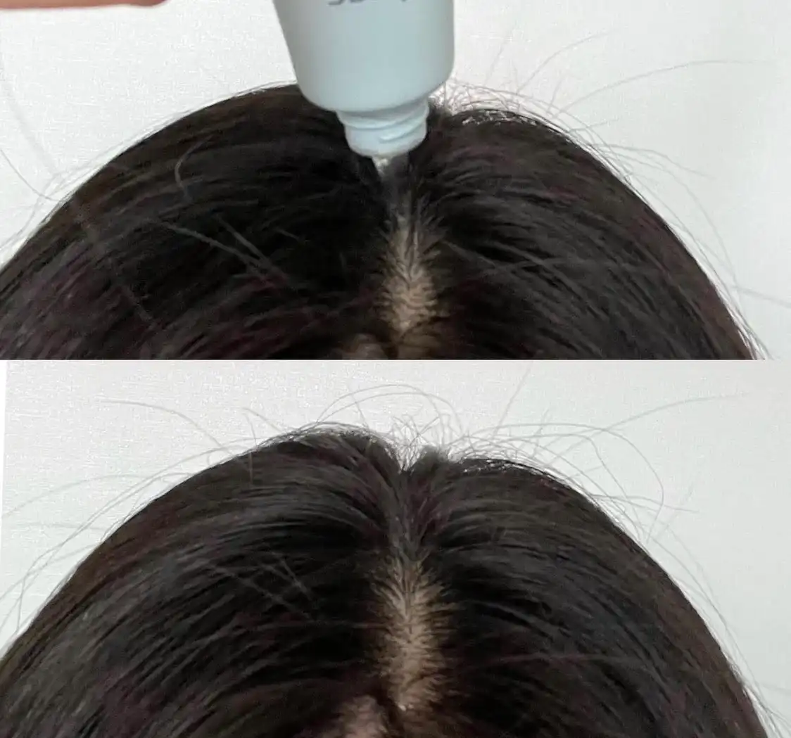 언니의파우치 리뷰 이미지 3 - [헤어루트 스칼프 에센스]