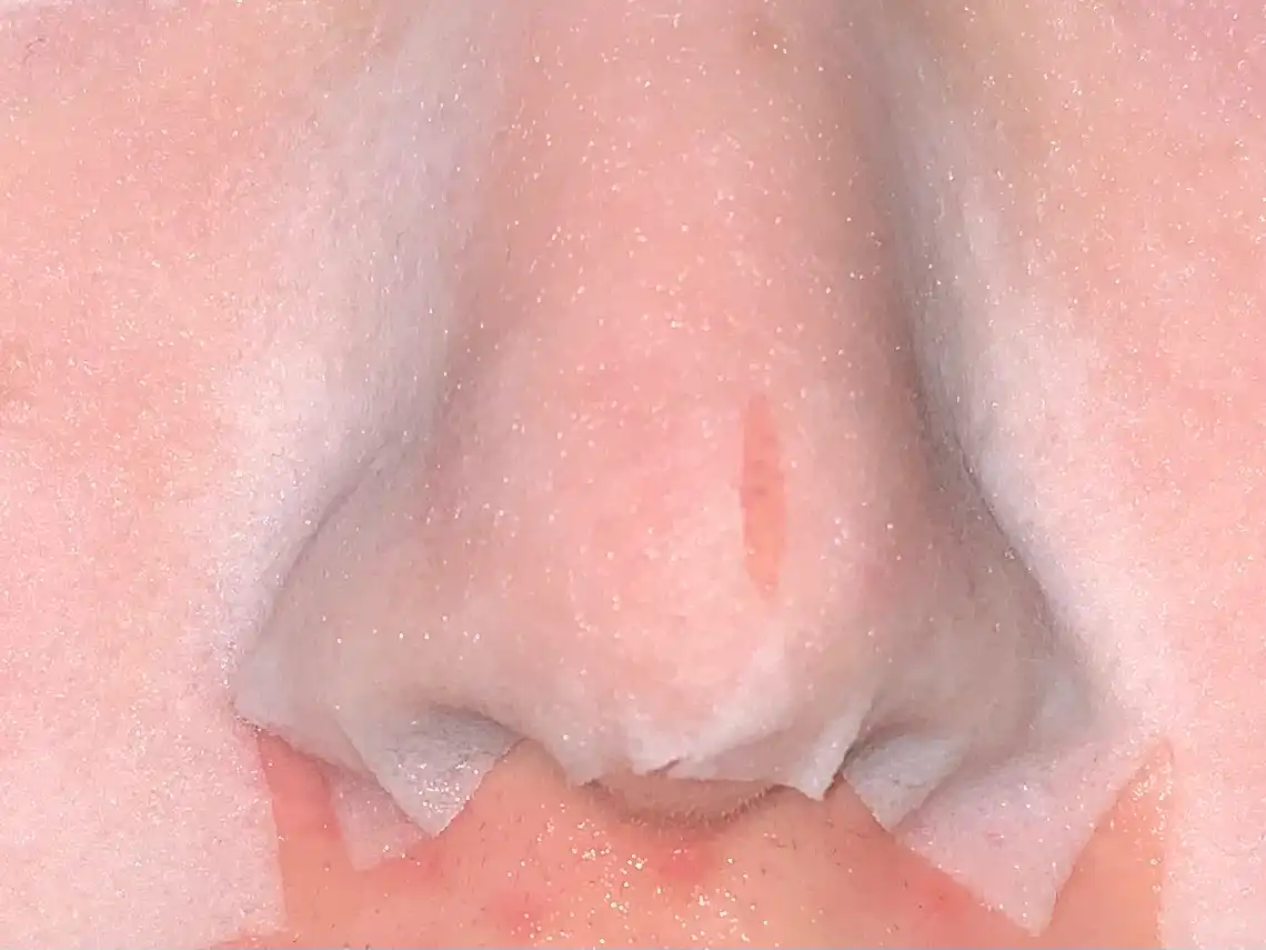 언니의파우치 리뷰 이미지 7 - [녹두 모공 스케일링 워터]