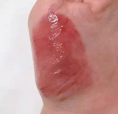 글로우 픽싱 틴트