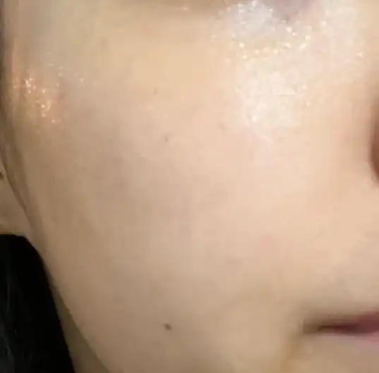 언니의파우치 리뷰 이미지 3 - [헬프미 에코 인텐스 세라마이드 앰플패드]