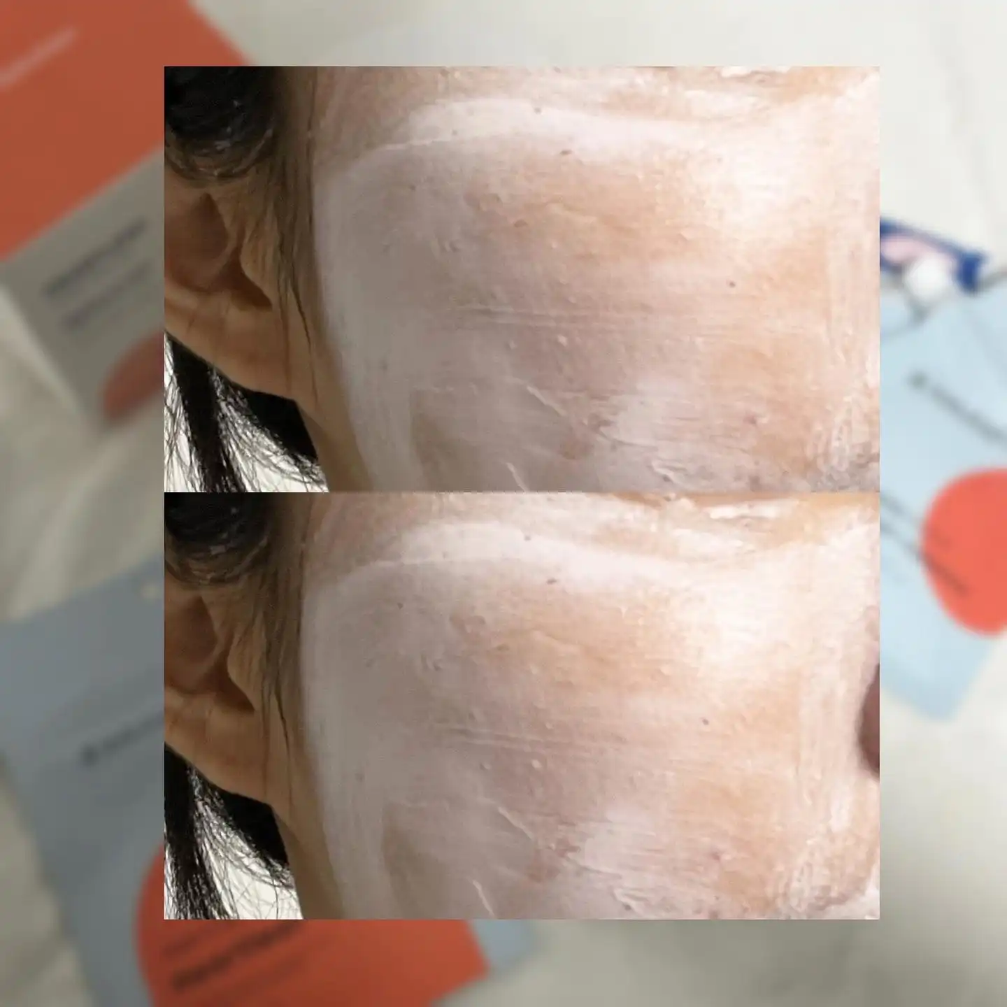 선택된 언니의파우치 리뷰 이미지 - [어성초 칼라민 퀵진정 팩]