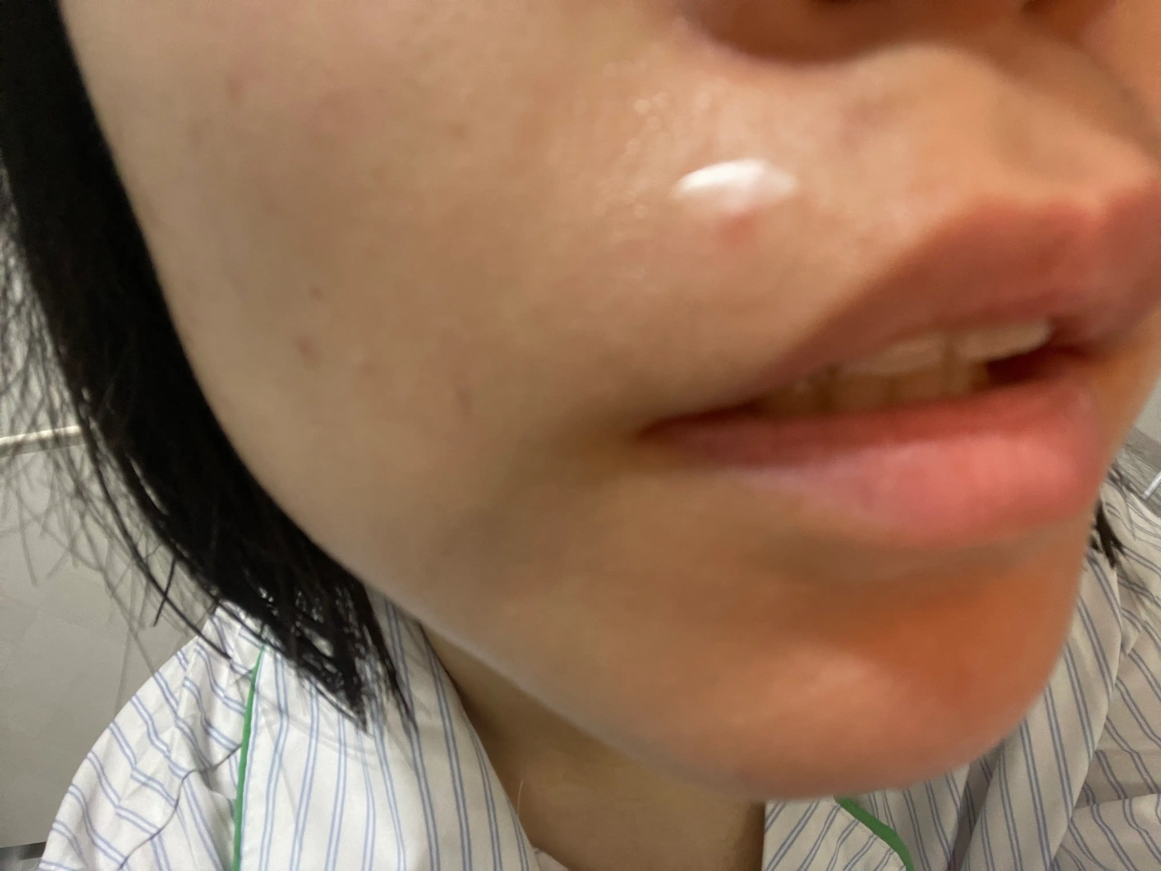 언니의파우치 리뷰 이미지 3 - [티트리 수딩 스팟패치]