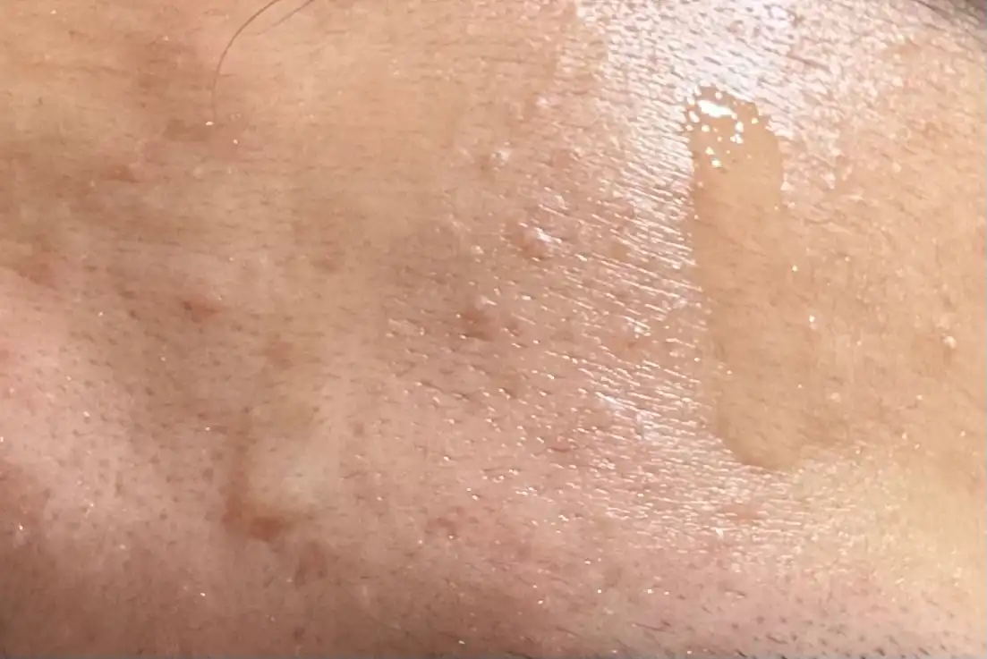 언니의파우치 리뷰 이미지 3 - [히알루론산 워터 플럼핑 수분 세럼]