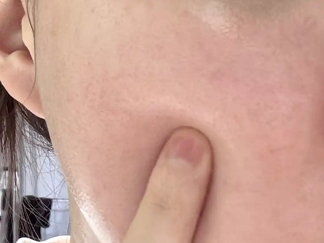 언니의파우치 리뷰 이미지 3 - [리얼 히알루로닉 블루 100 앰플]