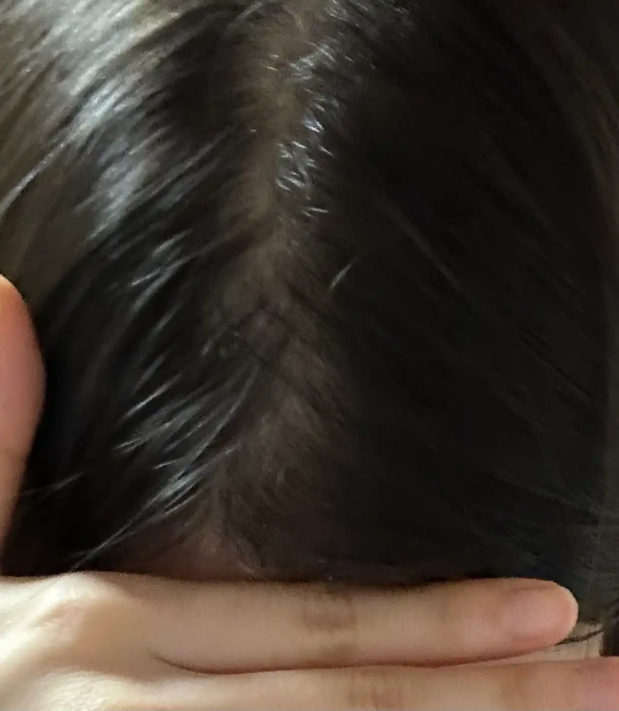 언니의파우치 리뷰 이미지 3 - [두피강화 클리닉 앰플 토닉]