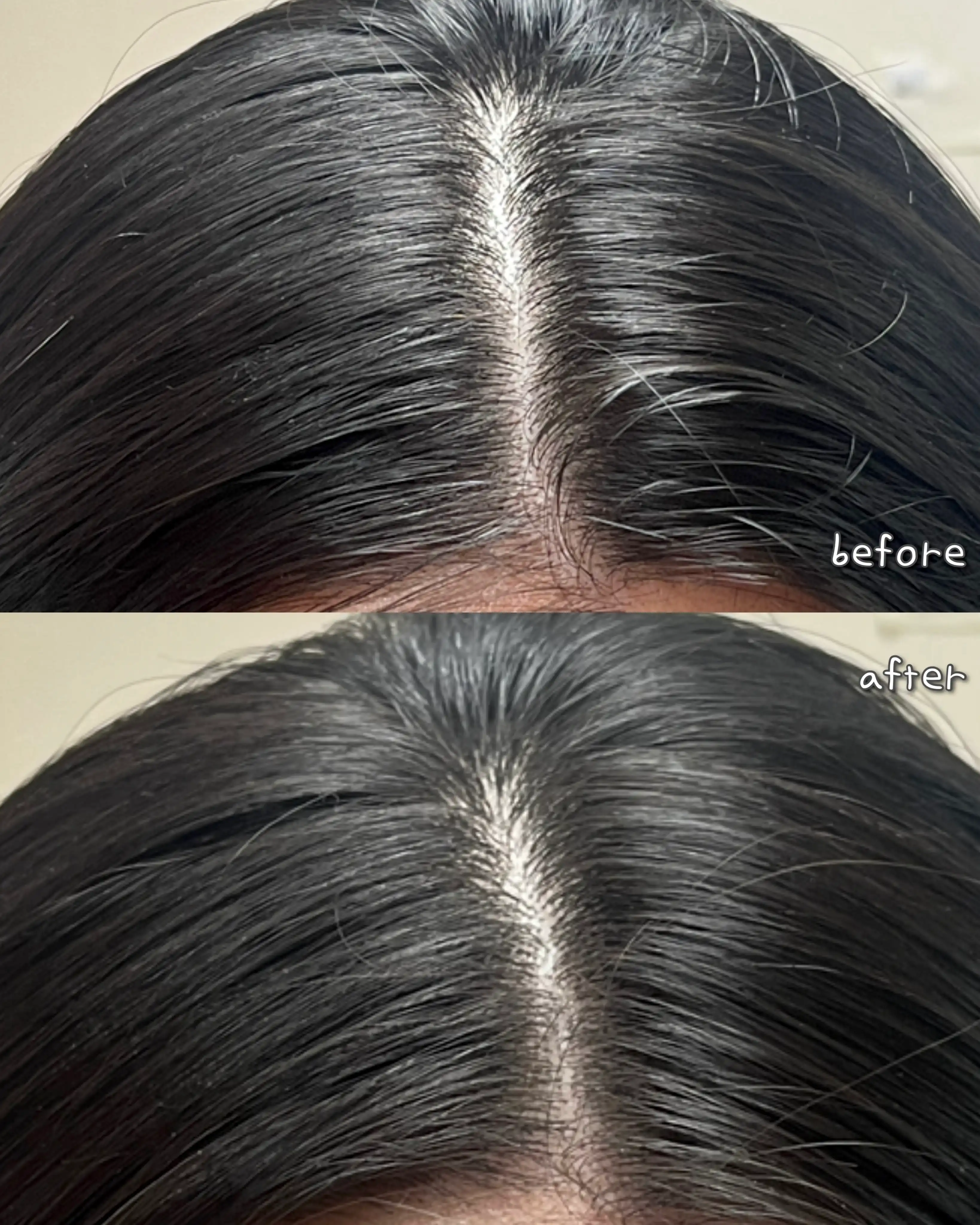 언니의파우치 리뷰 이미지 3 - [마데카 정수리를 닦자]