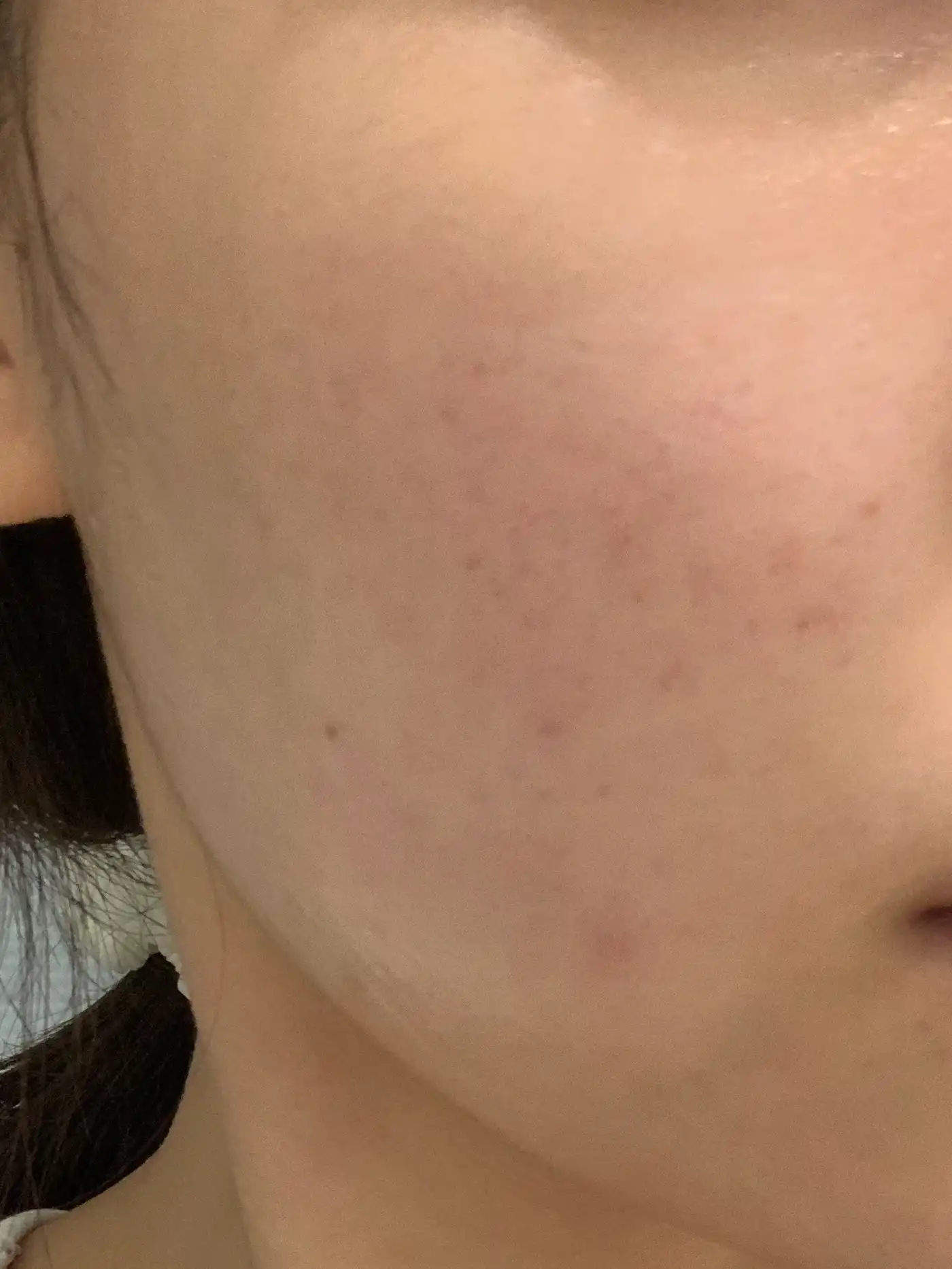 언니의파우치 리뷰 이미지 3 - [로제 피디알엔 에센셜 마스크 모공 결광]