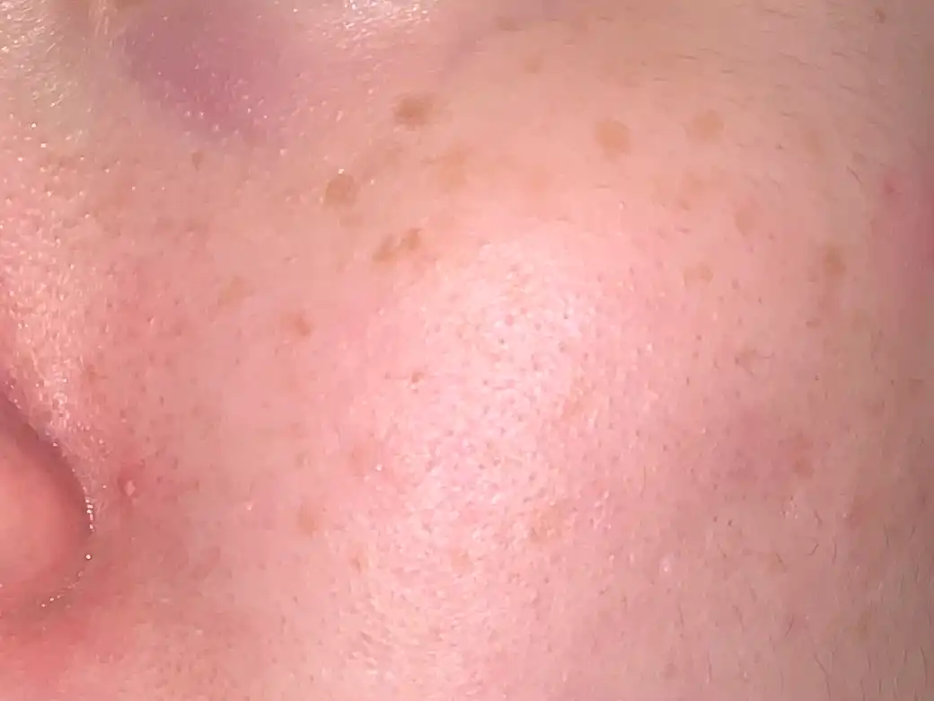 언니의파우치 리뷰 이미지 6 - [블레미쉬 효소 파우더 클렌저]