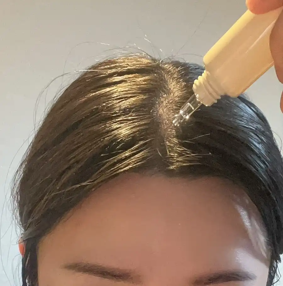 언니의파우치 리뷰 이미지 3 - [탈모증상완화 두피 영양 앰플]