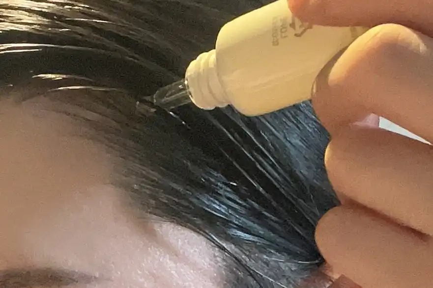 언니의파우치 리뷰 이미지 4 - [탈모증상완화 두피 영양 앰플]