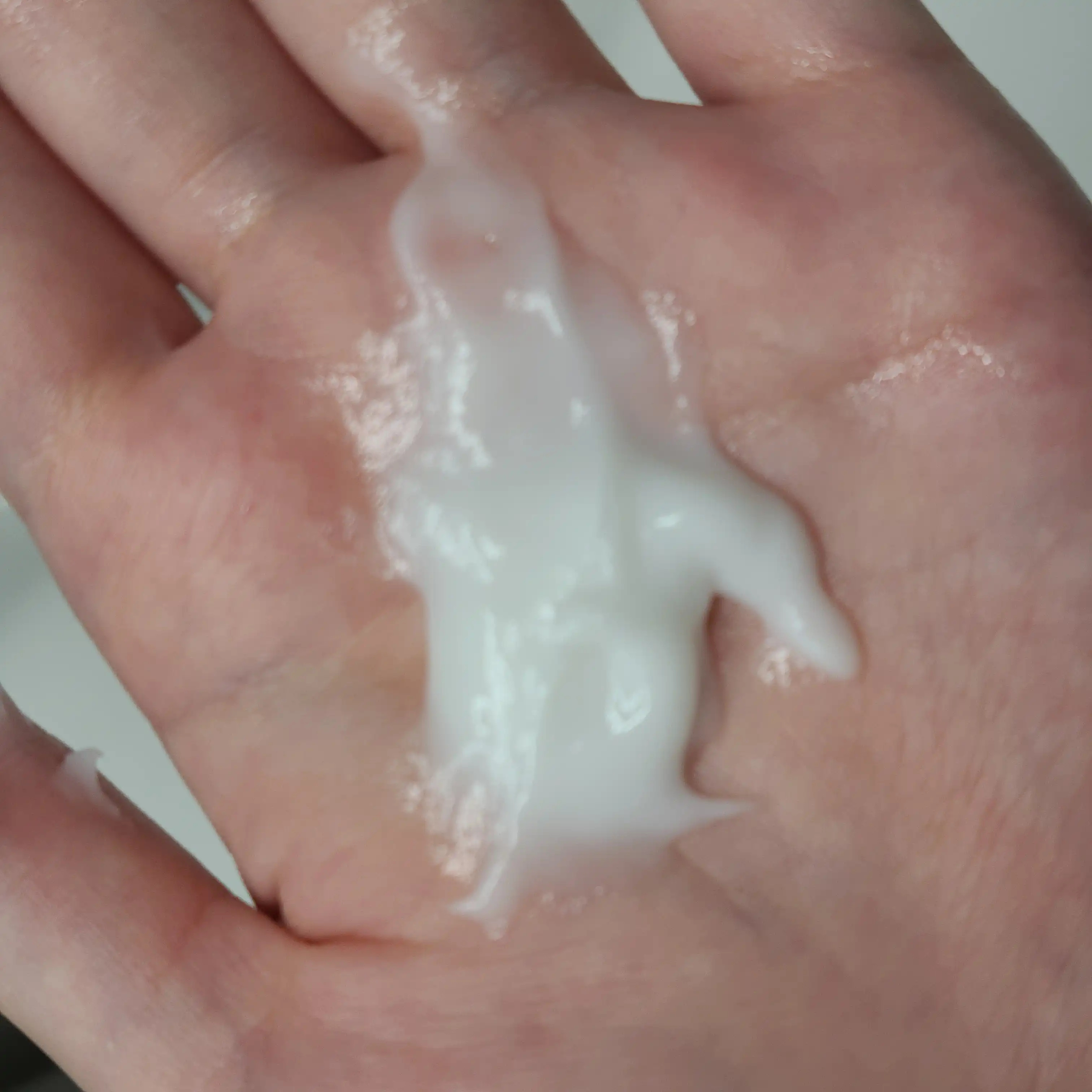 언니의파우치 리뷰 이미지 2 - [루트젠 여성 맞춤 탈모증상전문케어 트리트먼트]