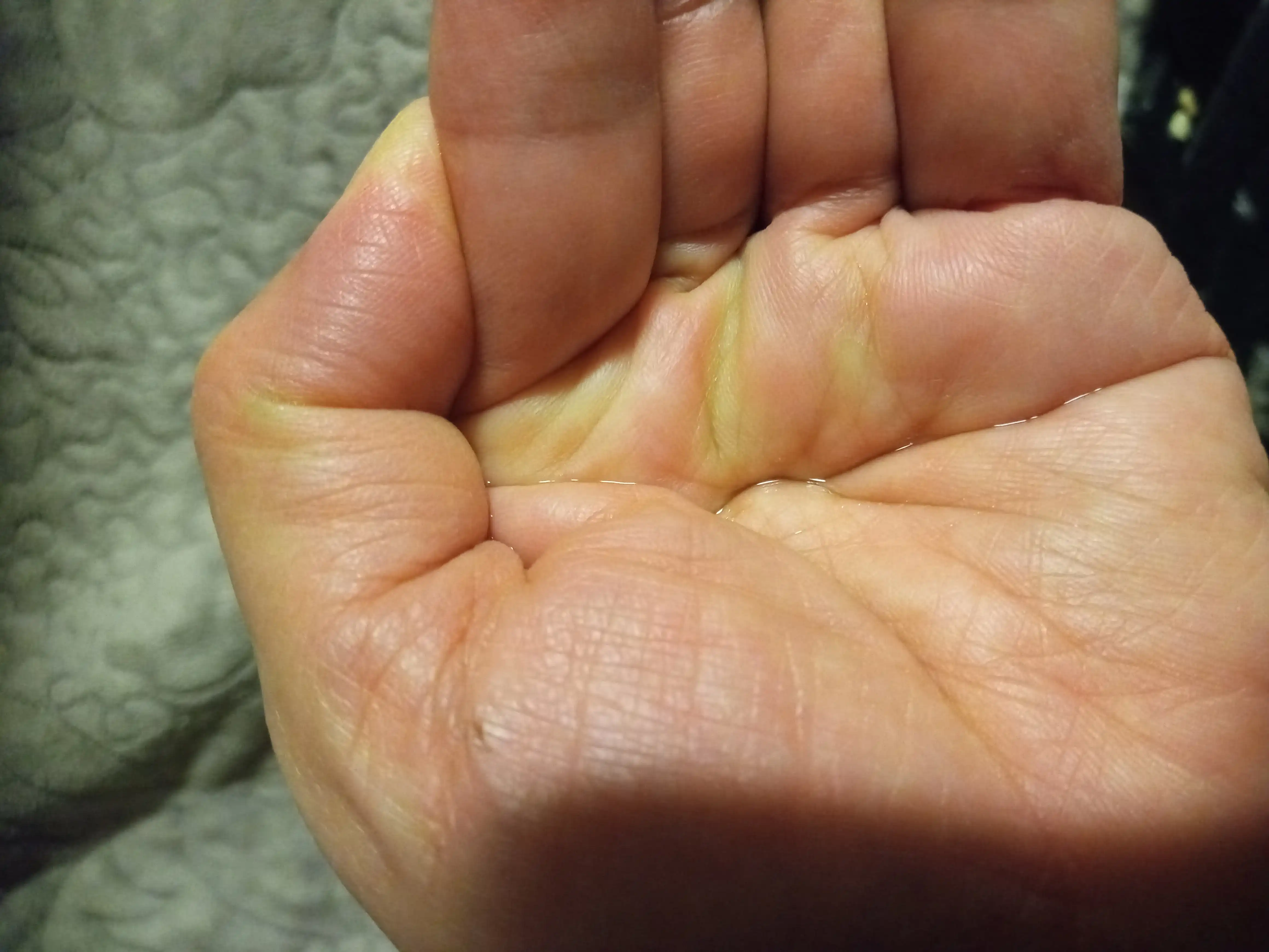 언니의파우치 리뷰 이미지 2 - [엔젤아쿠아 수분 진정 토너]