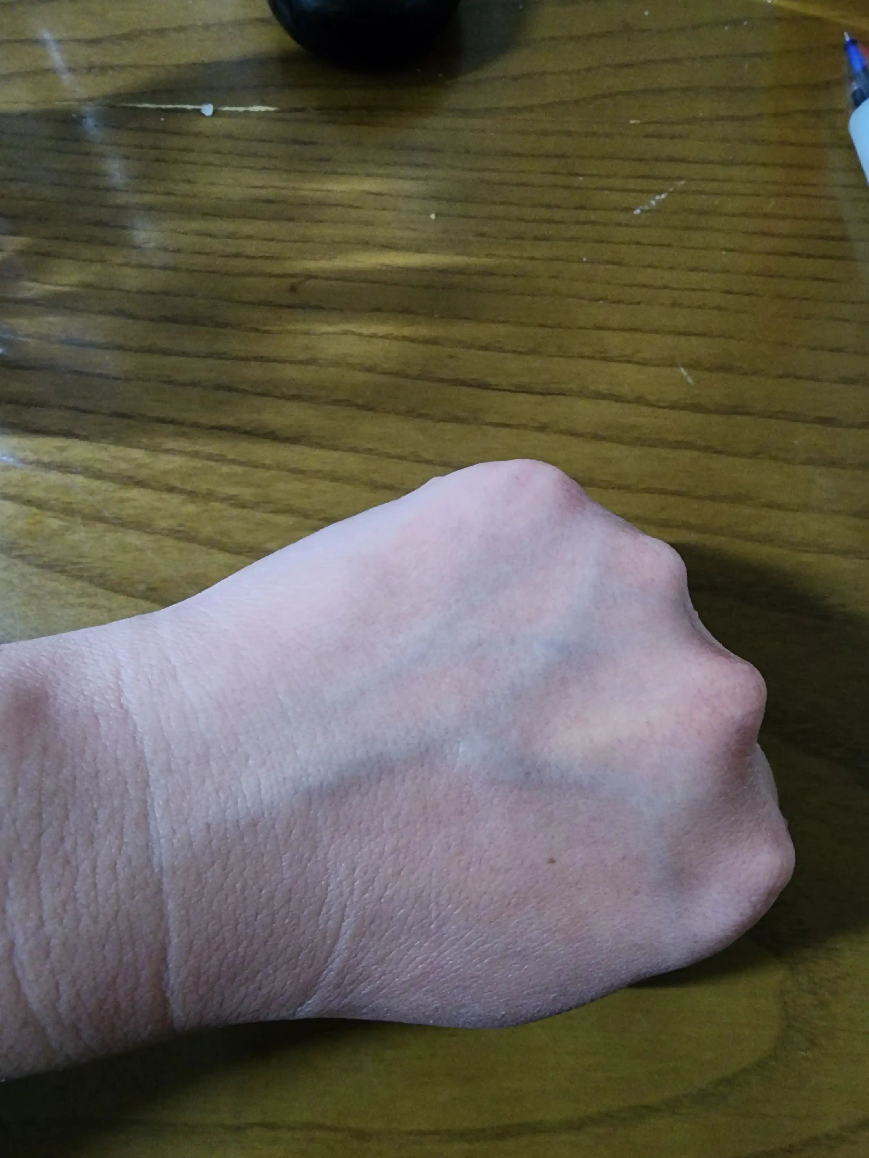 언니의파우치 리뷰 이미지 2 - [(아따맘마 에디션) 프로폴리스 트리트먼트 앰플 에센스]