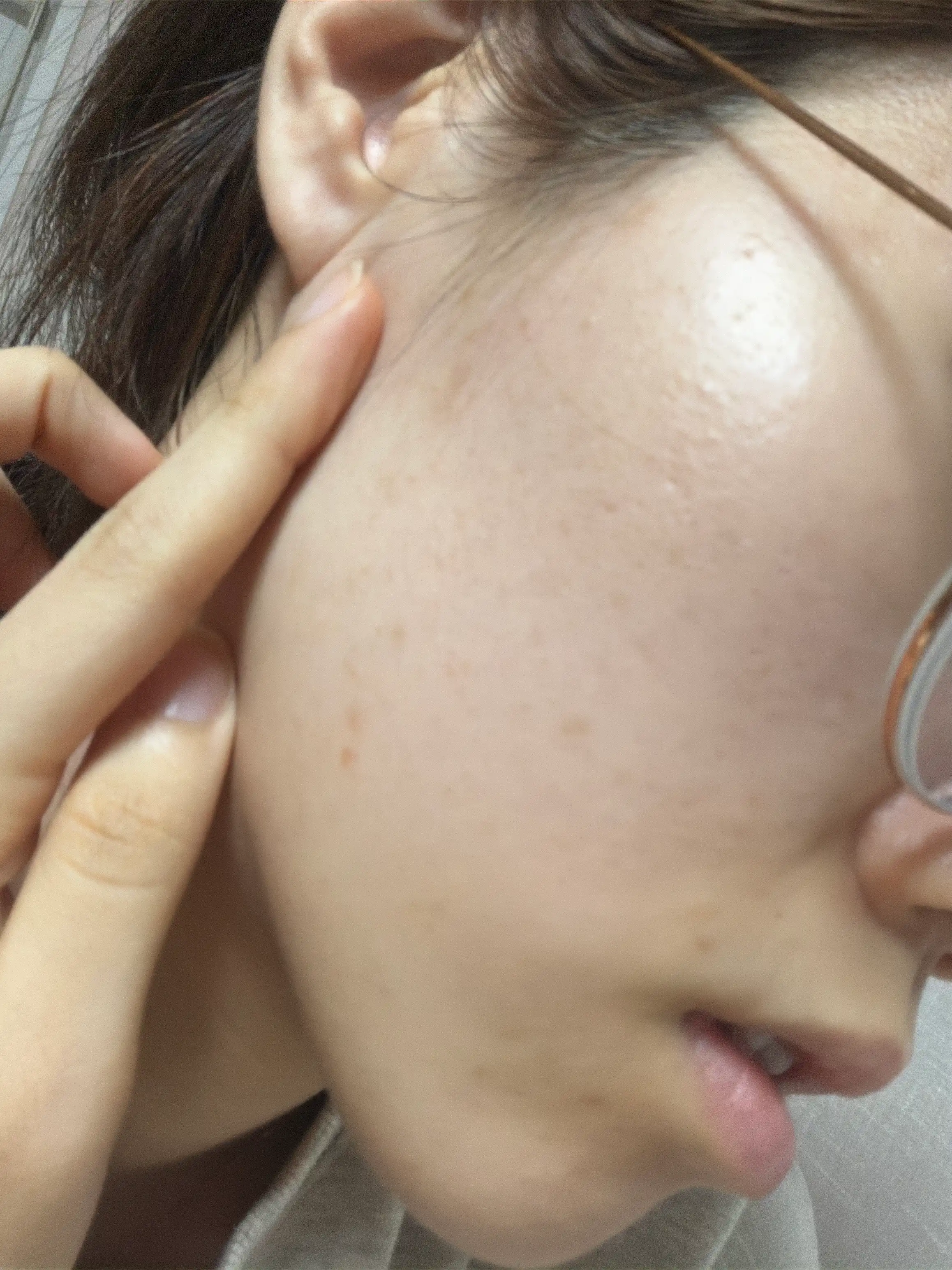 선택된 언니의파우치 리뷰 이미지 - [마데카소사이드 흔적 리페어 더마 크림]