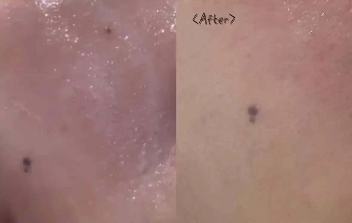 언니의파우치 리뷰 이미지 3 - [하이온 보배제주 클렌징젤]