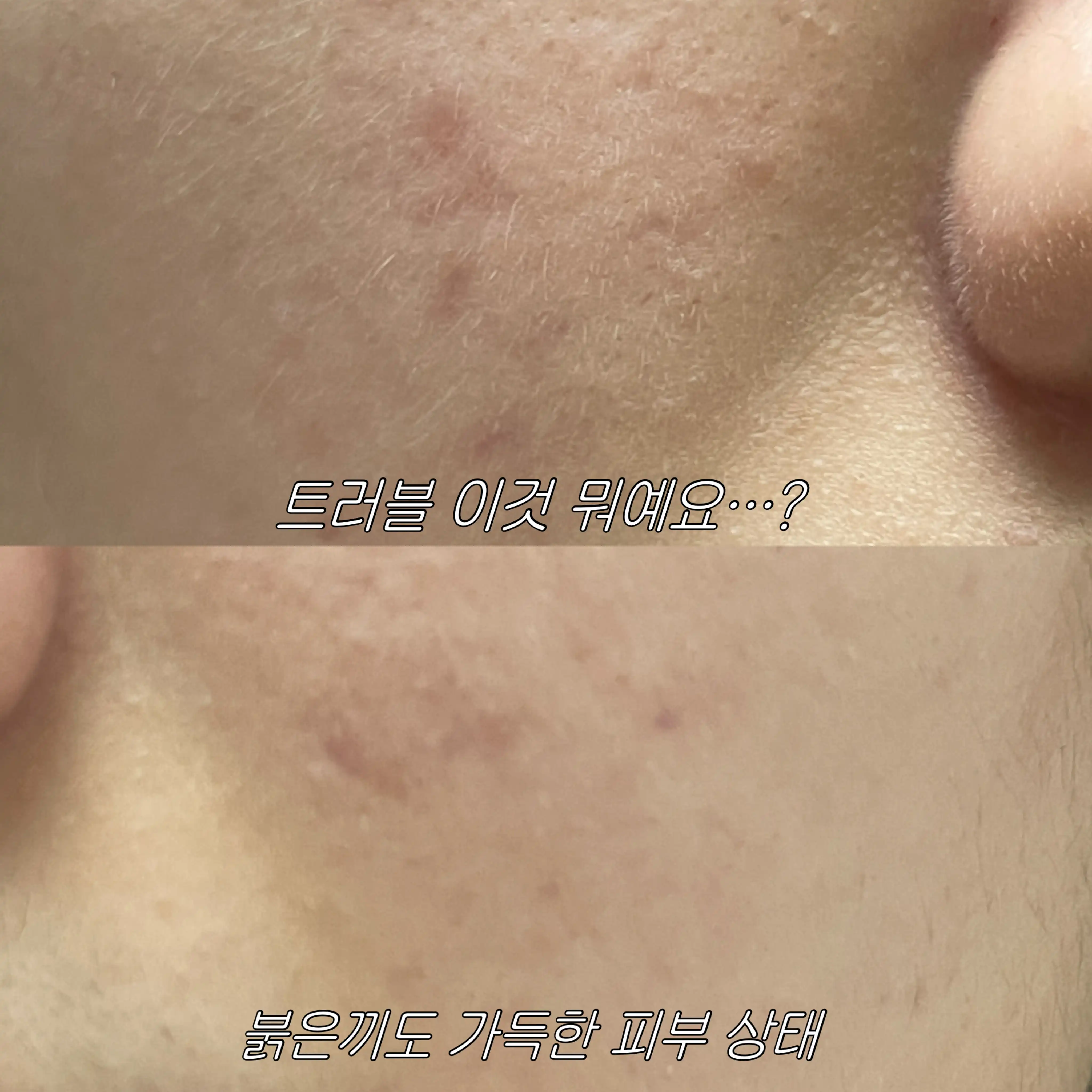 언니의파우치 리뷰 이미지 2 - [어성초 흔적 에센스 패드 클리어터치]