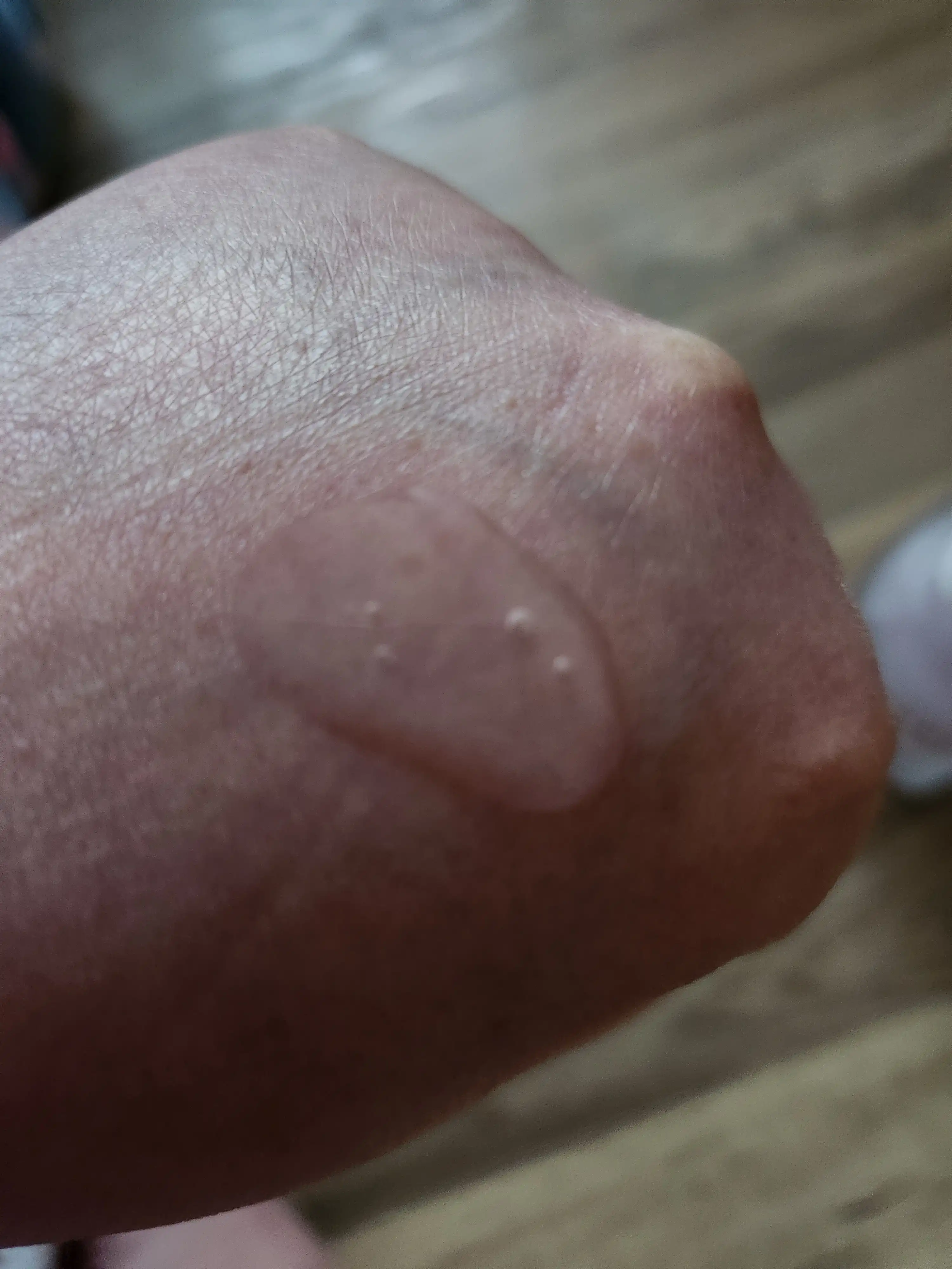 언니의파우치 리뷰 이미지 - [레츠 킬 어글리 타임 디퍼프 앰플]