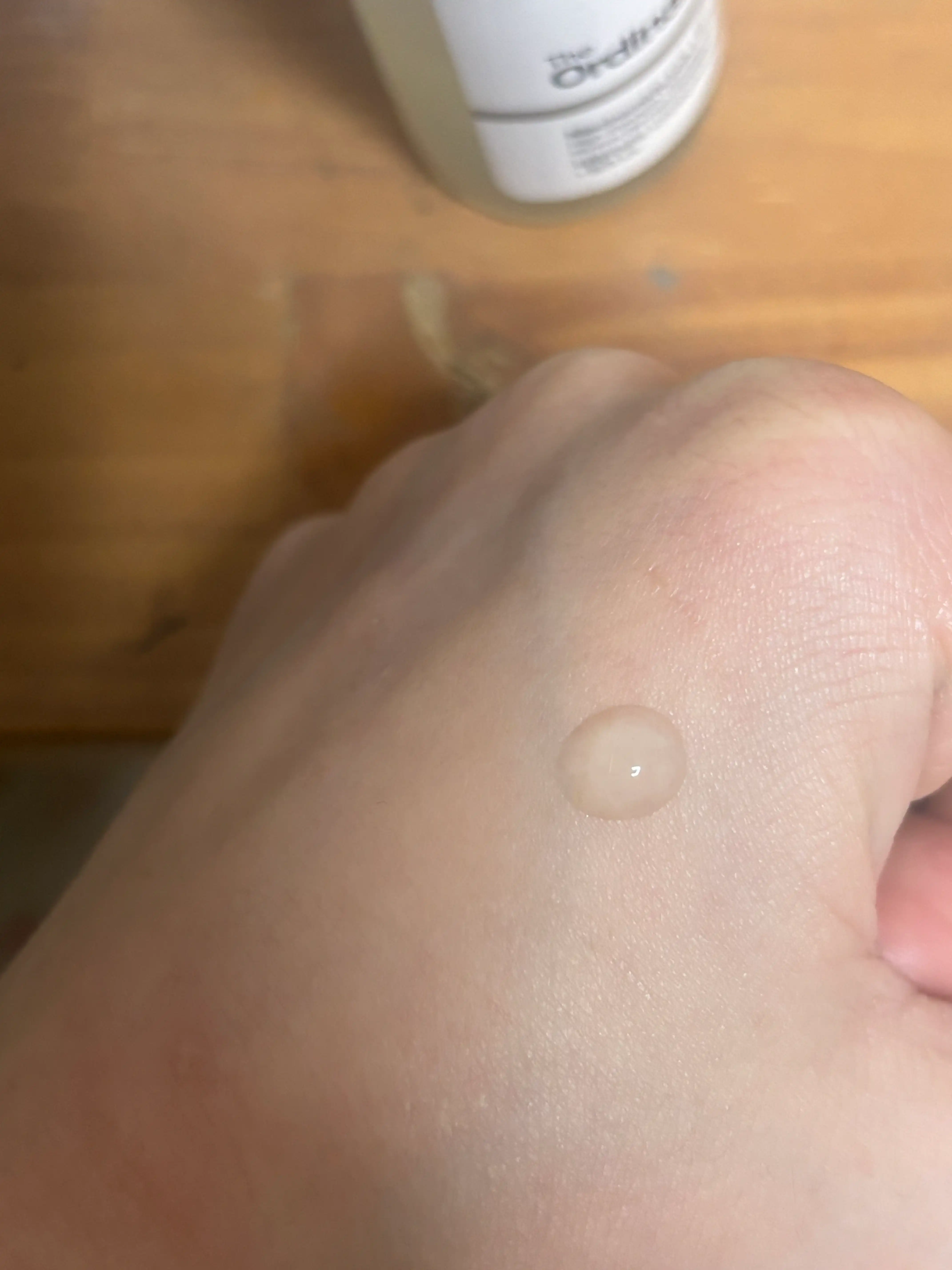 언니의파우치 리뷰 이미지 3 - [나이아신아마이드 10프로 플러스 징크 1프로]