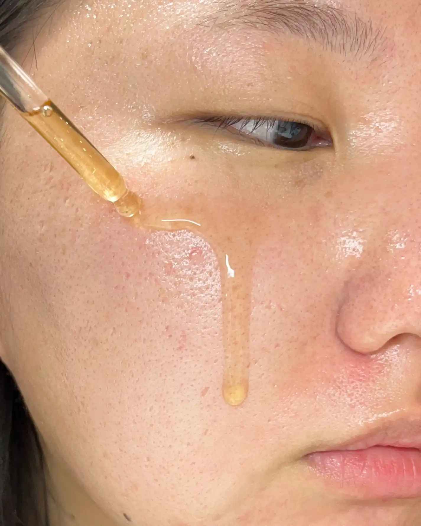 언니의파우치 리뷰 이미지 3 - [클리니컬 나이아신아마이드 20퍼센트 트리트먼트]