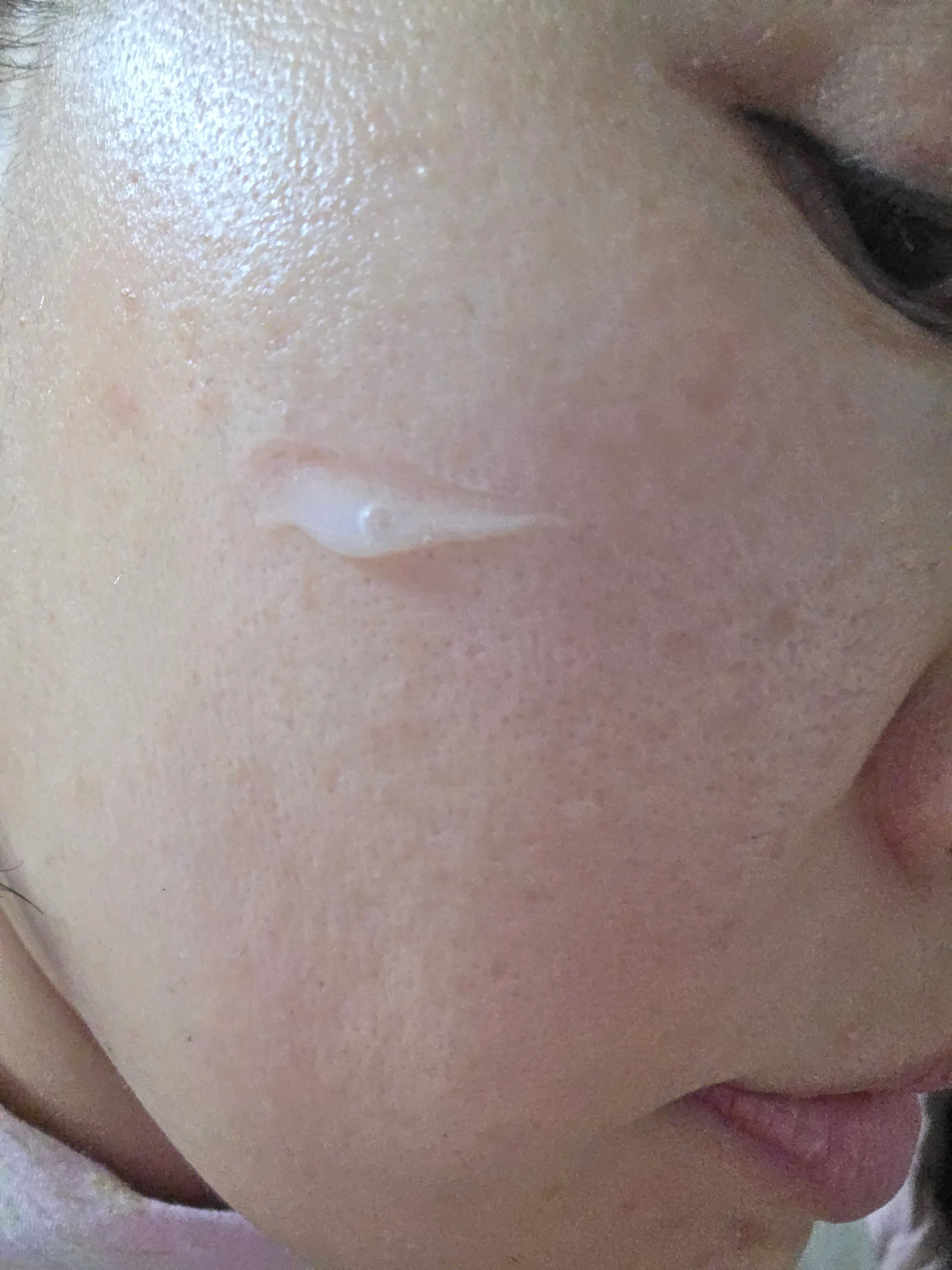 선택된 언니의파우치 리뷰 이미지 - [마데카 마이크로 스타톡 세럼]