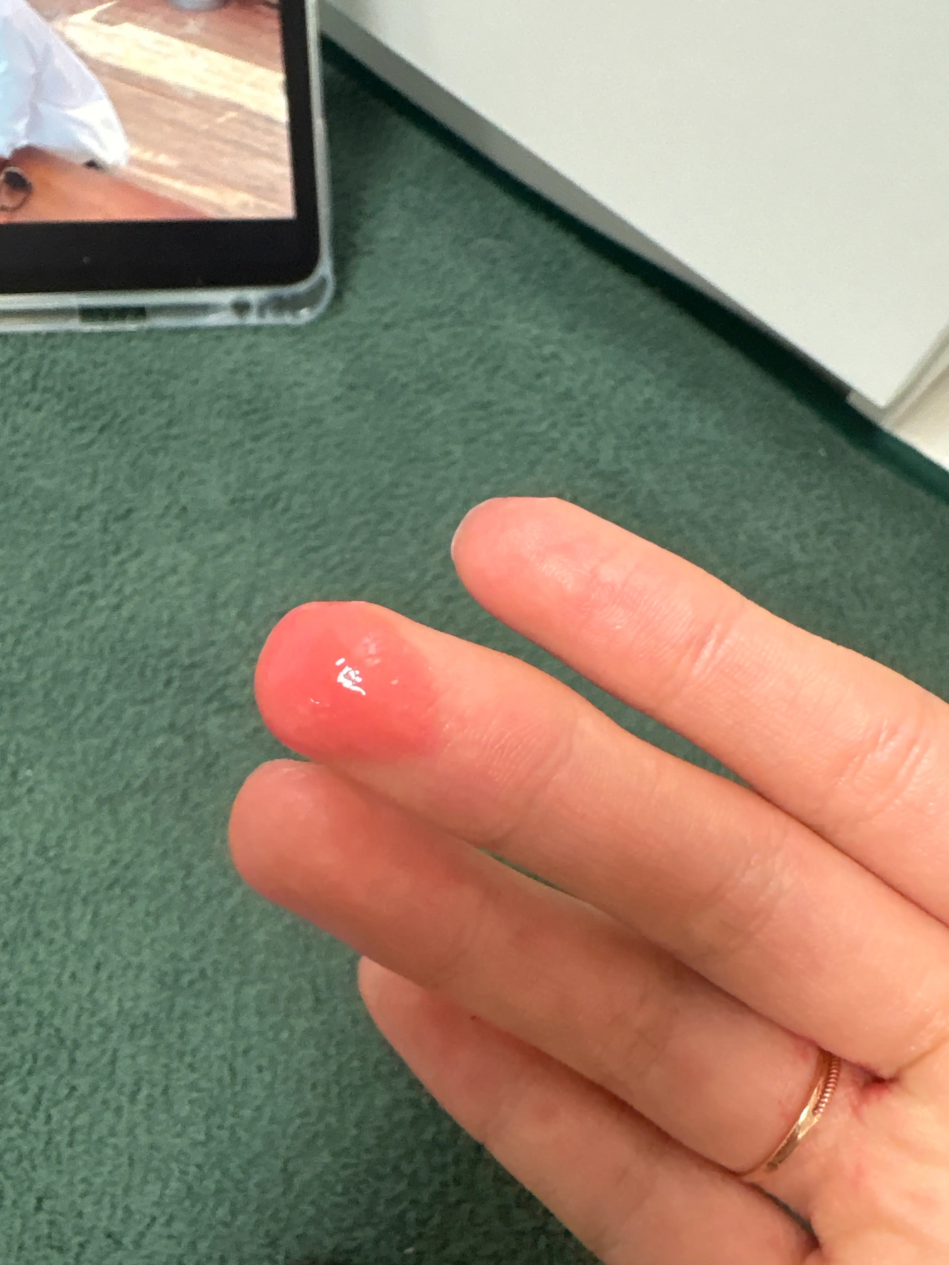 선택된 언니의파우치 리뷰 이미지 - [로 글로우 듀이 볼]