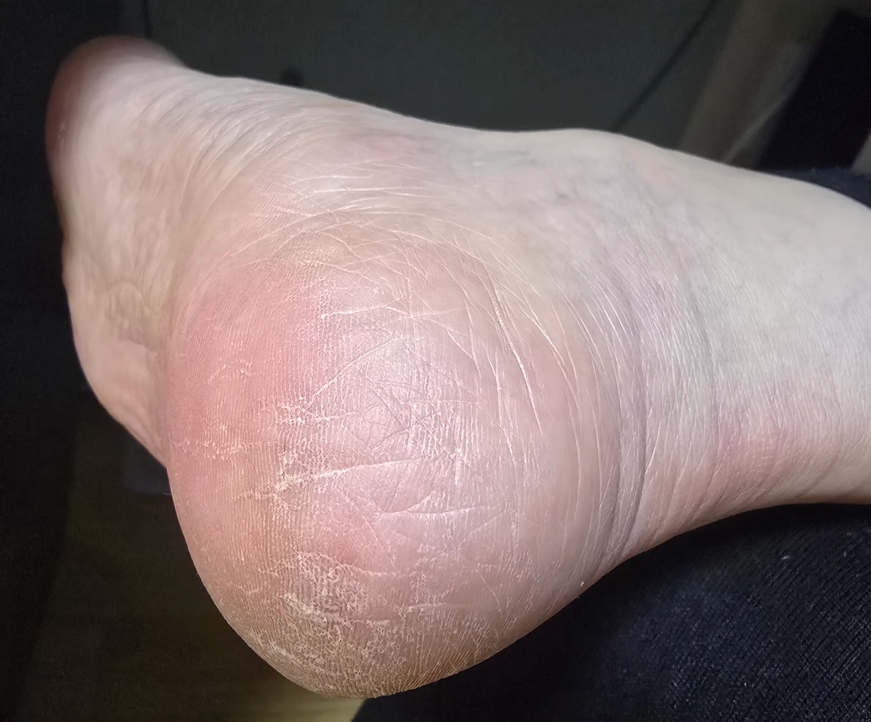 선택된 언니의파우치 리뷰 이미지 - [시어 핸즈 앤 바디 엑스트라 젠틀 로션]