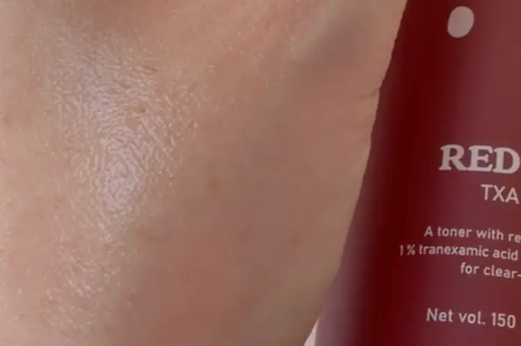 선택된 언니의파우치 리뷰 이미지 - [레드빈 트라넥사믹애씨드 토너]