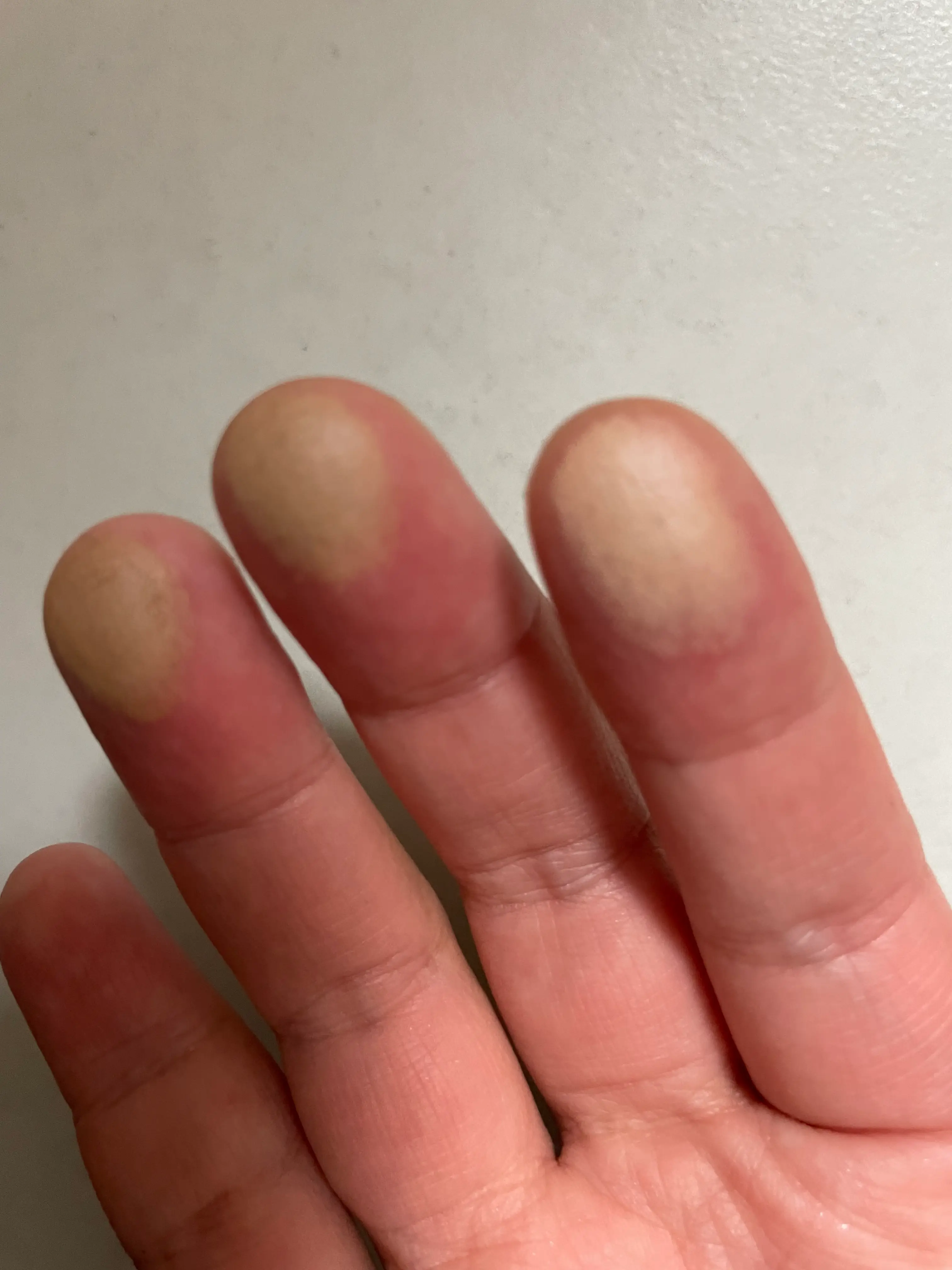 선택된 언니의파우치 리뷰 이미지 - [바이로댕 쉐이딩]