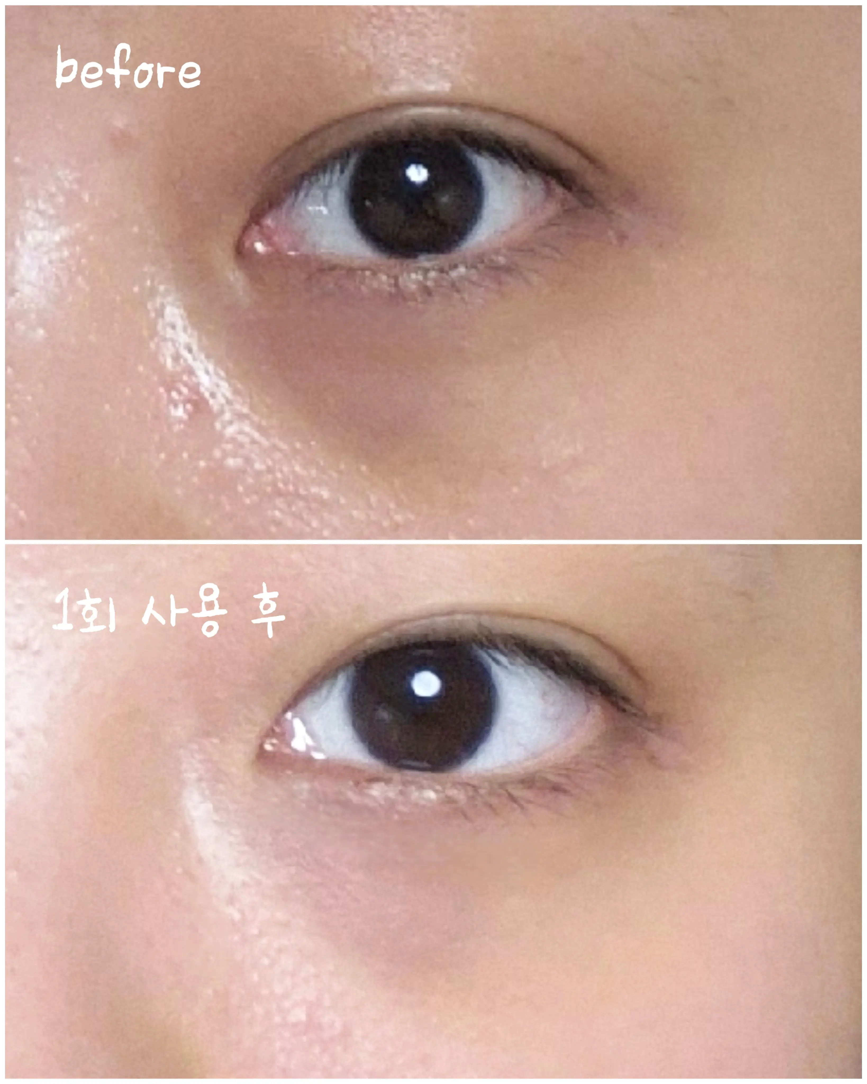 선택된 언니의파우치 리뷰 이미지 - [아이백 브라이트닝 2200샷 패치]