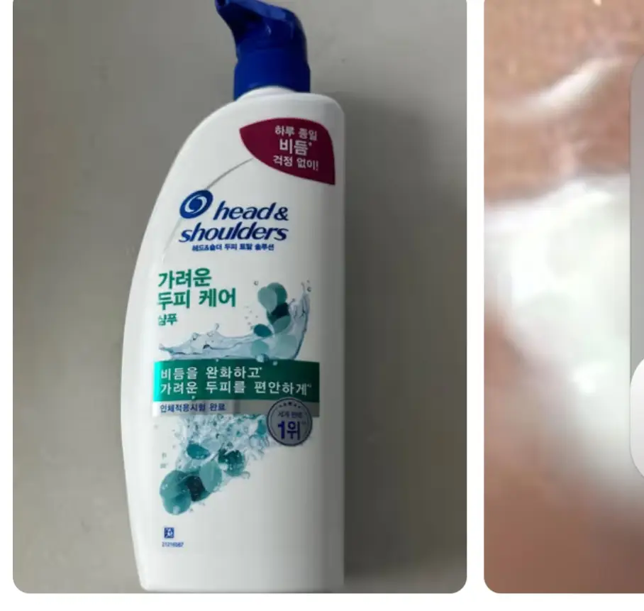 선택된 언니의파우치 리뷰 이미지 - [2in1 가려운 두피 케어]