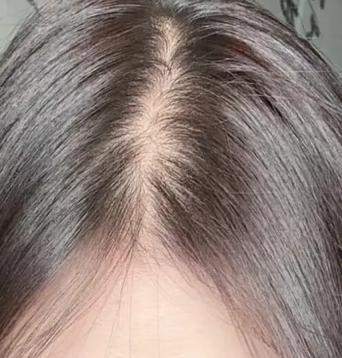 선택된 언니의파우치 리뷰 이미지 - [채울 샴푸 ]
