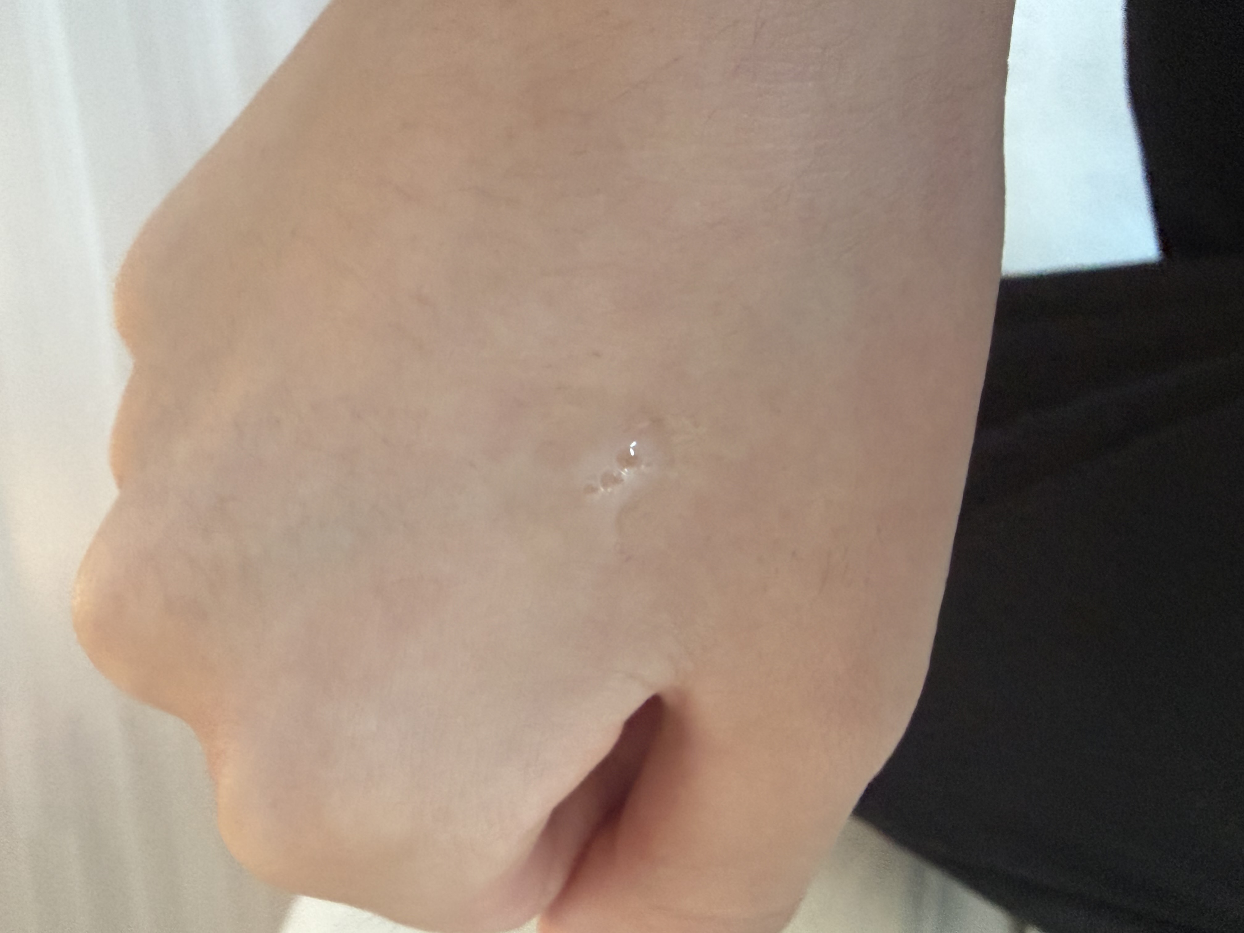선택된 언니의파우치 리뷰 이미지 - [마데카소사이드 흔적 리페어 세럼]