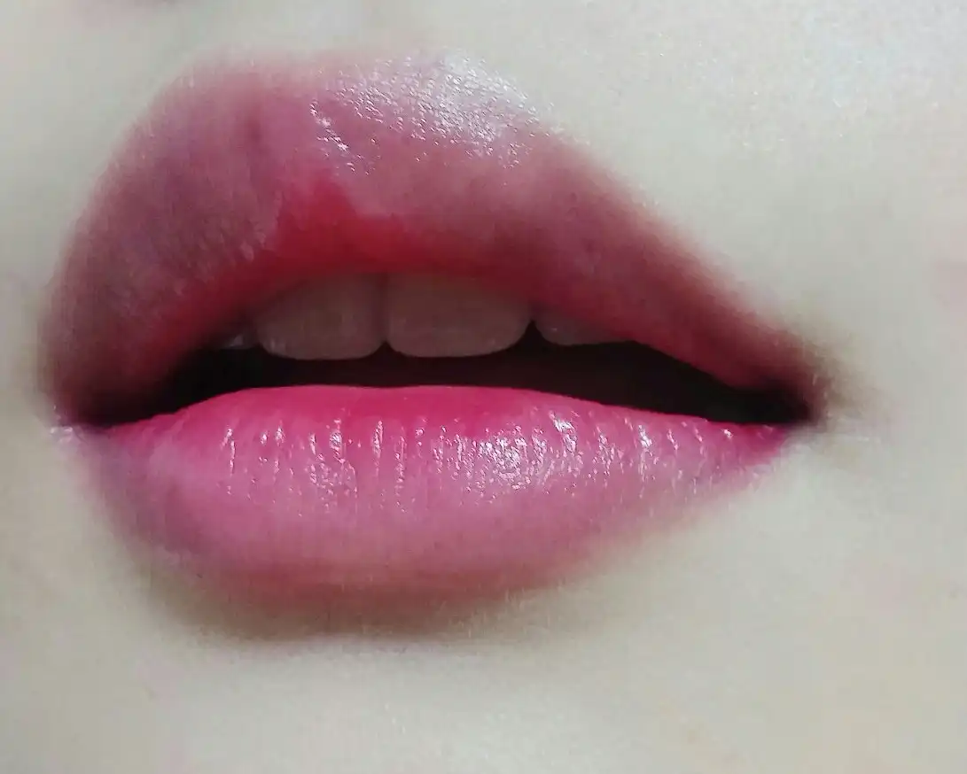 foxiefox