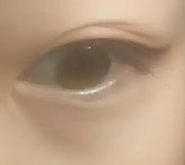 몽에