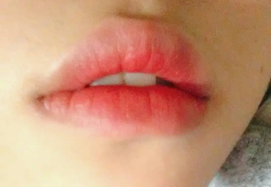 점점