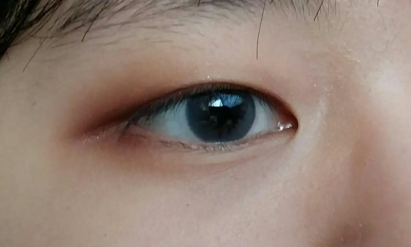 현잉몬