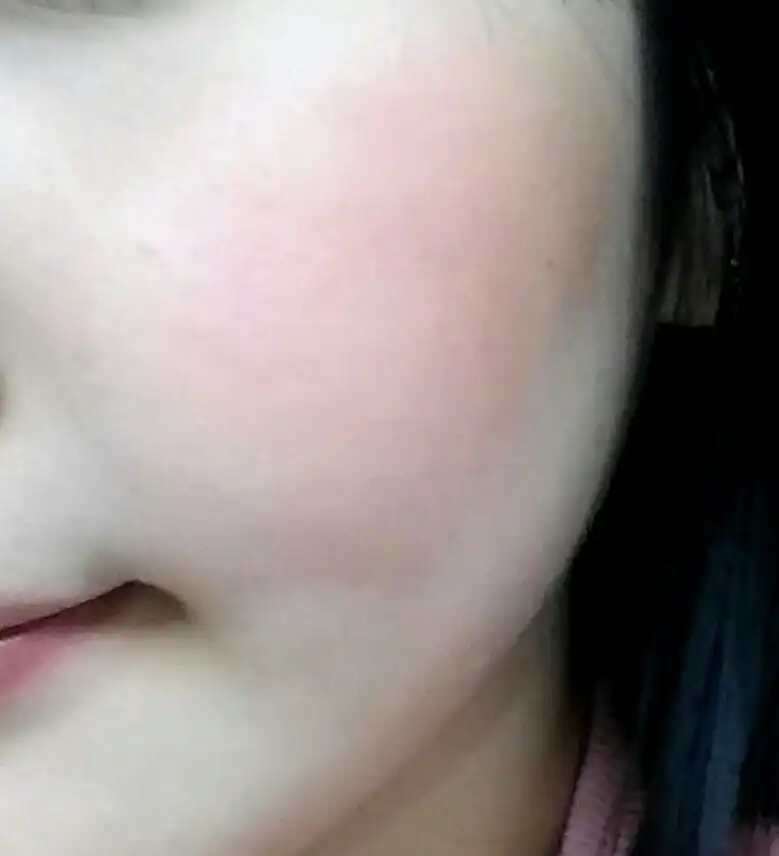 여우자리